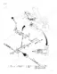 Case 1845B skid steer loader Exploded view of the parking brake lever and linkage assembly